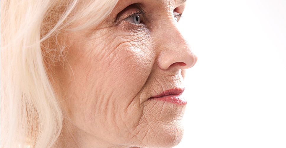 Concerns Skin Ageing Sun Damage 1 - Anova Skin Clinic