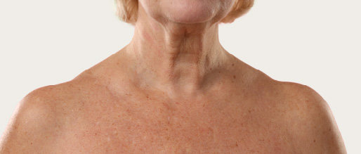 Skin Ageing & Sun Damage