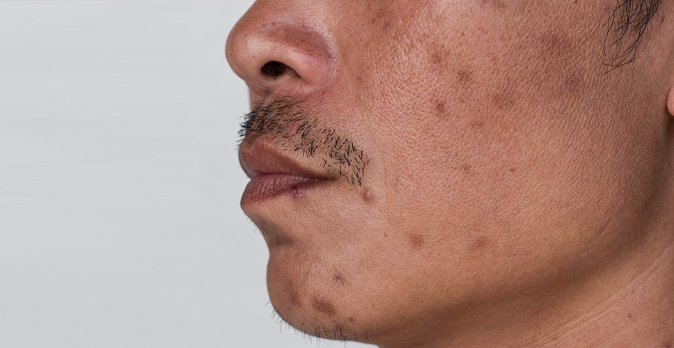 Forms Post Injury 2 - Anova Skin Clinic