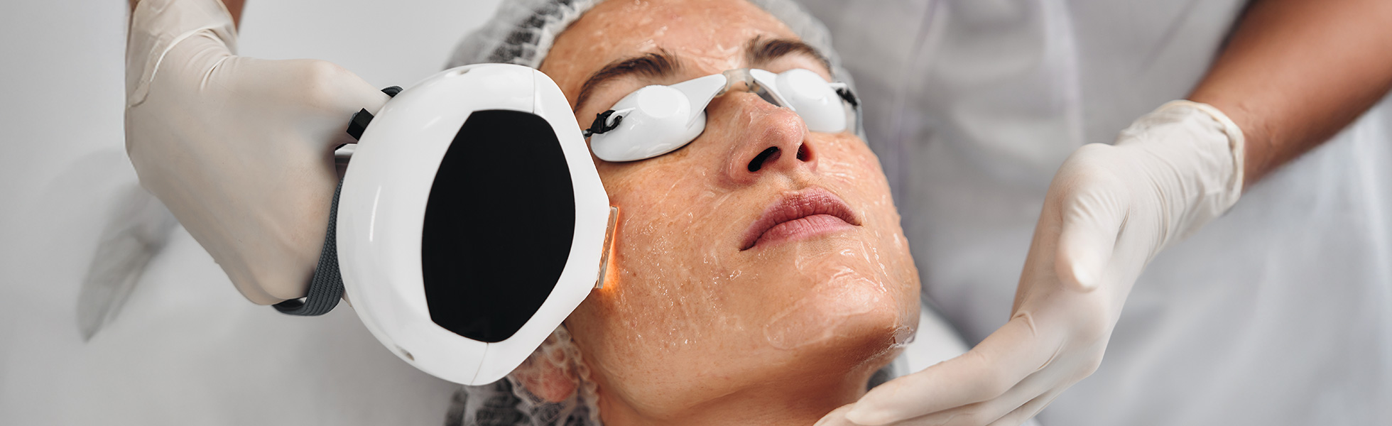 IPL Rejuvenation
