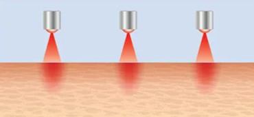 LED light therapy competitors comparison 2