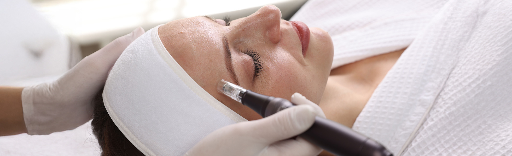 Microneedling