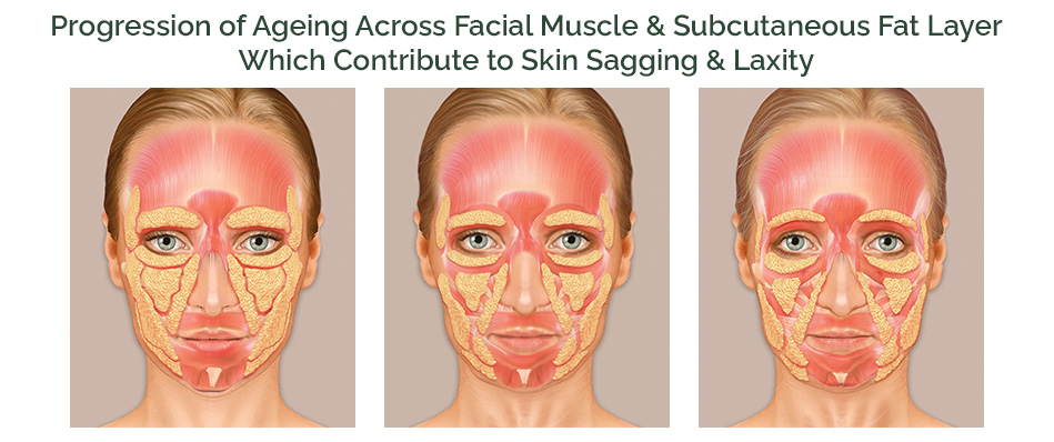 Skin sagging and laxity on the face