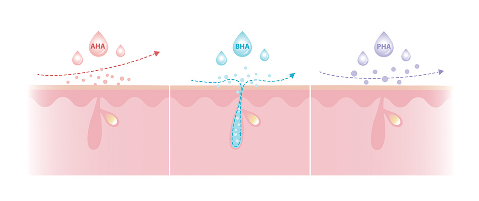 Beta hydroxy acid skin treatment