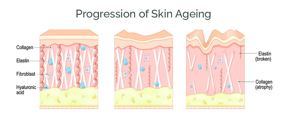 Symptoms of skin ageing diagram